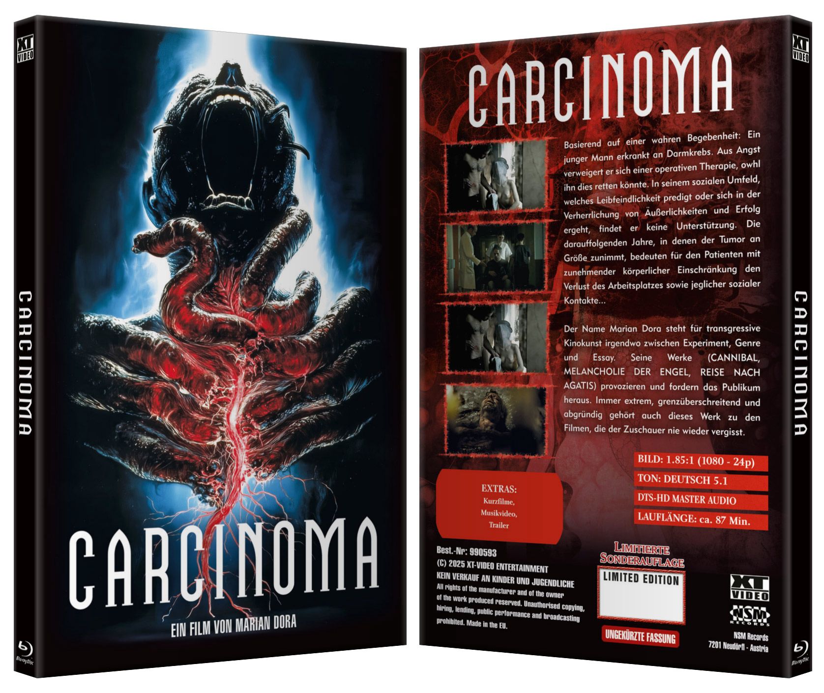Carzinoma I gr. Hartbox - XT Video - Lim. 55